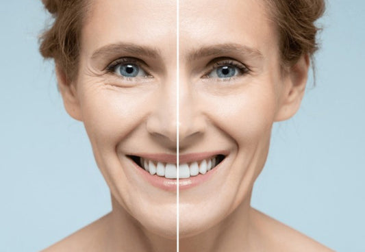 Premièrement, conçu pour réduire les rides, ridules et signes de relâchement cutané, il nourrit en profondeur et restaure l’élasticité de la peau, laissant le visage plus ferme et lumineux.