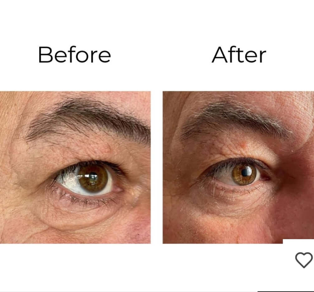 Peptilux - Anti-wrinkle eye cream with "shock action" effect and LIPHASYN™ - 20ML (Code: LUX001)