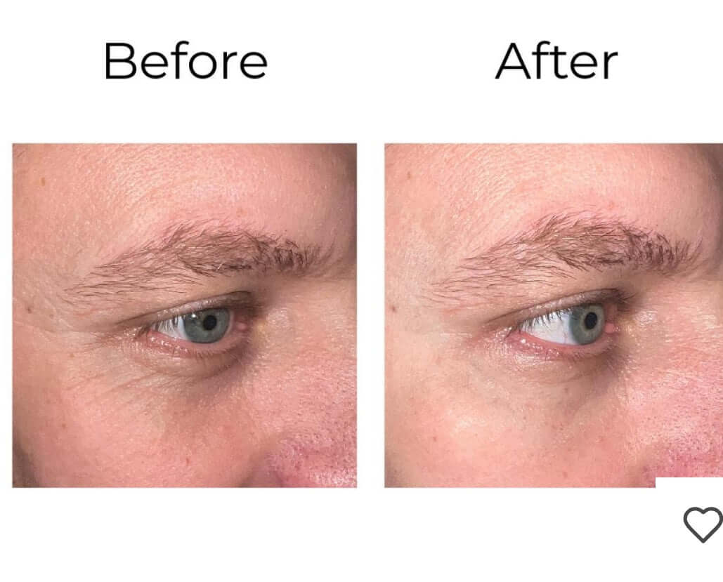 Premièrement,, la gamme Peptilux de Chogan a été développée pour offrir une réponse ciblée et efficace aux signes visibles de l’âge.