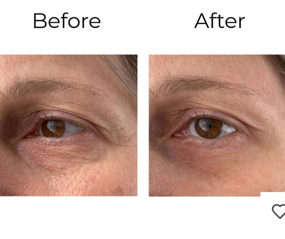 Premièrement,, la gamme Peptilux de Chogan a été développée pour offrir une réponse ciblée et efficace aux signes visibles de l’âge.