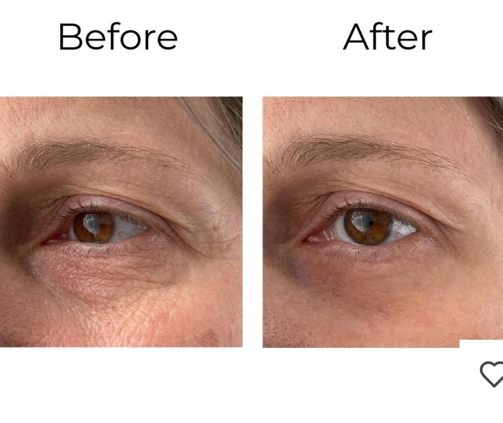 Pour commencer, la gamme Peptilux de Chogan a été développée pour offrir une réponse ciblée et efficace aux signes visibles de l’âge.